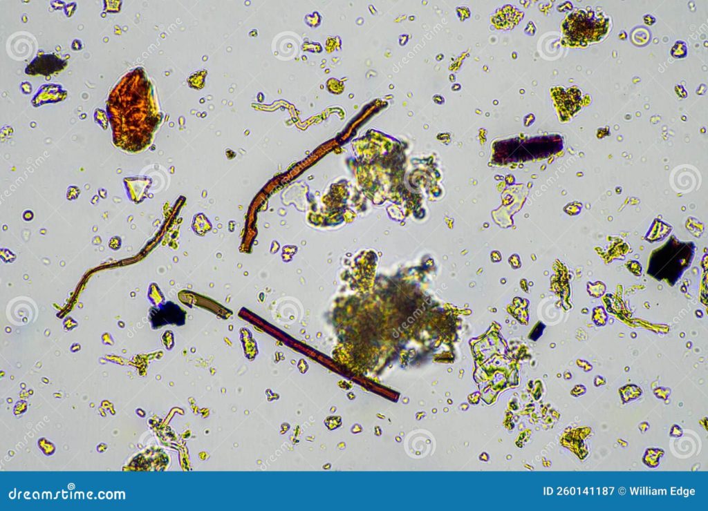 microorganismos y biologia del suelo con nematodos hongos bajo el microscopio en una muestra de compost primavera 260141187