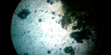 Microscopio y muestras de hongos